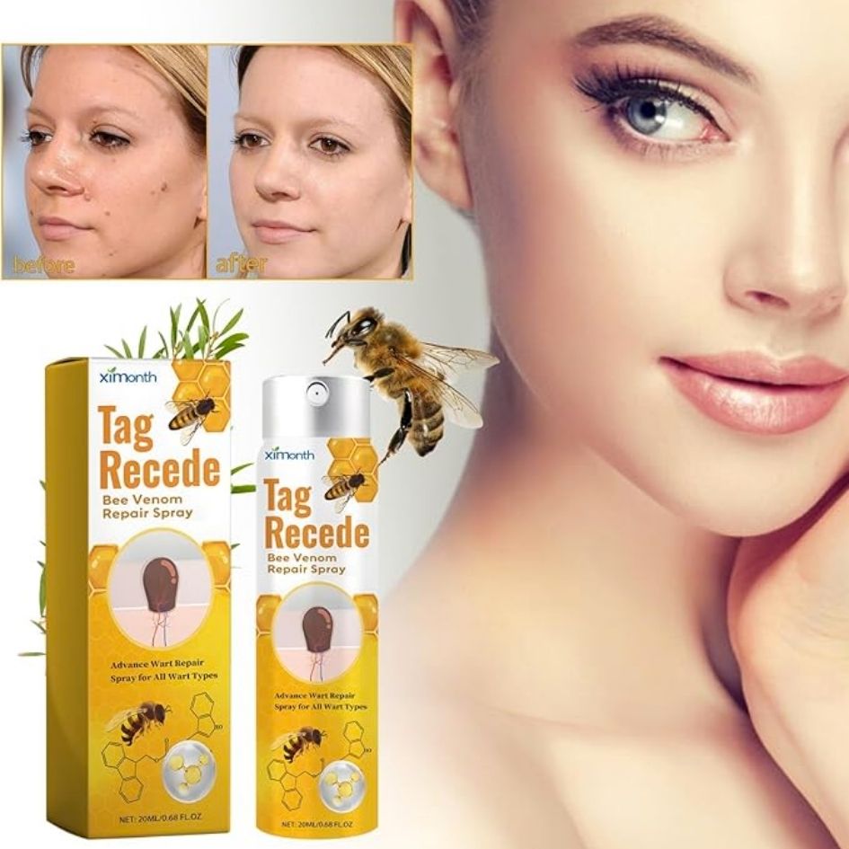 REMOVEDOR SPRAY QUITA VERRUGAS Y MEZQUINOS