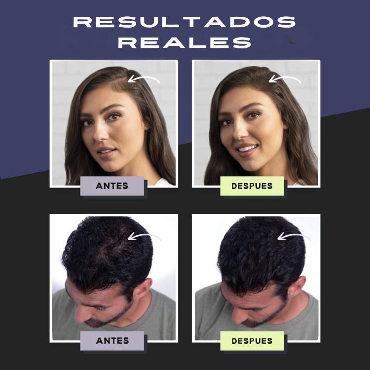 FIBRAS CAPILARES DE DENSIDAD TOPPIK 27.5GR